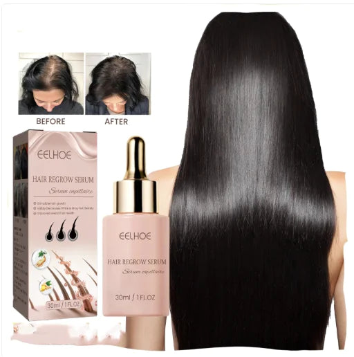 Hair Loss Serum And Hair Fixation Nutrition